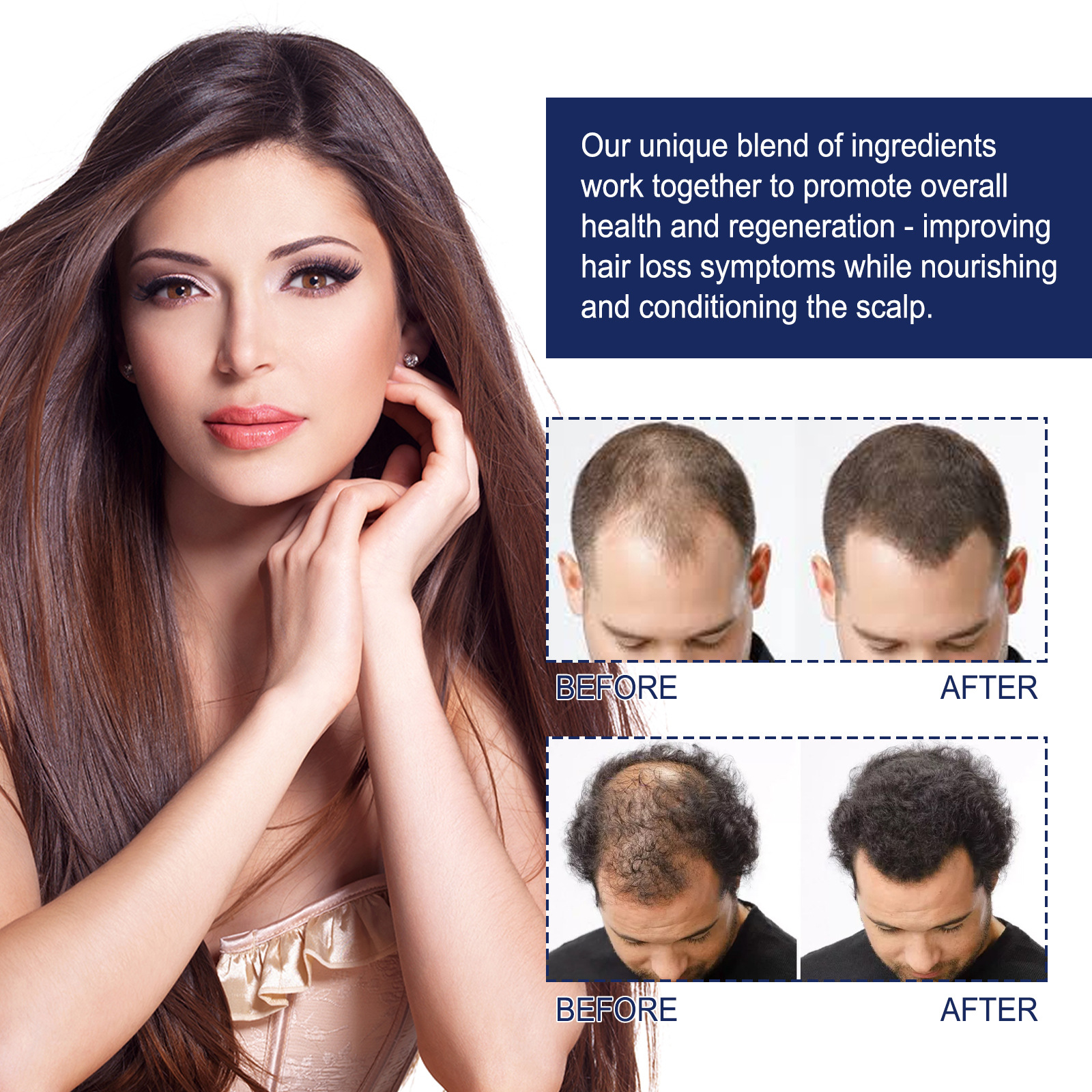 Aceite esencial de cuidado de hierbas EELHOE para el cuidado, cabello fuerte y firme, prevención de la caída, reparación del cabello denso y_voghion.com