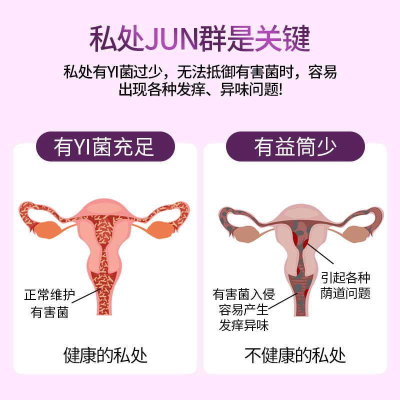 私密益生菌片 婦科活性乳酸桿菌護理私處保養抑菌佳茵女性益生菌