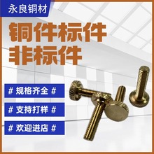 �ǘ˶����~�������ݽz�~��ĸ�~Ƕ��cnc�ӹ��S��ֱ�N�~�ӭh��㊴�