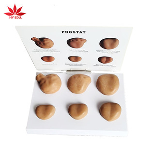 Medical Model Anatomy Teaching University Hospital Research Institute Medical Teaching Model Diseased Prostate Model