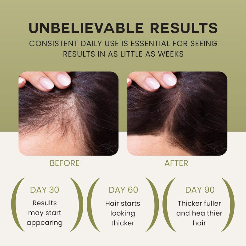 クロスボーダーヘアオイル バタナオイル 育毛 100% 育毛ヘアケア エッセンシャルオイル バタナオイル|undefined