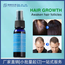 跨境爆品滋养头发护发液头皮护理喷雾护理精华液hairgrowth spray