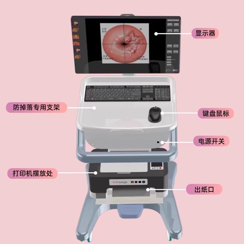 Colposcopio médico de alta definición endoscopio cervical vaginal colposcopio electrónico digital instrumento ginecológico de píxeles de alta definición