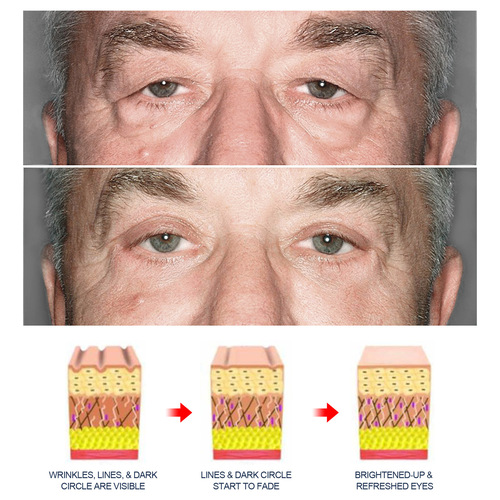 Anti-aging eye cream for men, lightening fine lines around the eyes, repairing eye bags and dark circles, hydrating and firming skin eye cream