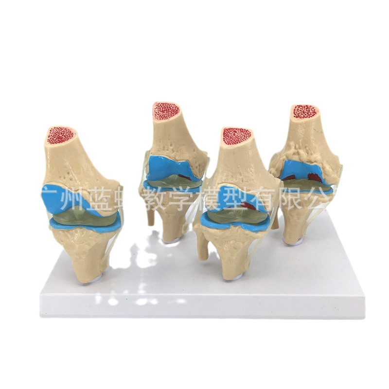 ��̬ ϥ�ؽ�ģ�� �Ľ׶β���ϥ�ؽ�ģ�� ���� ����ϥ�ؽ�ģ��