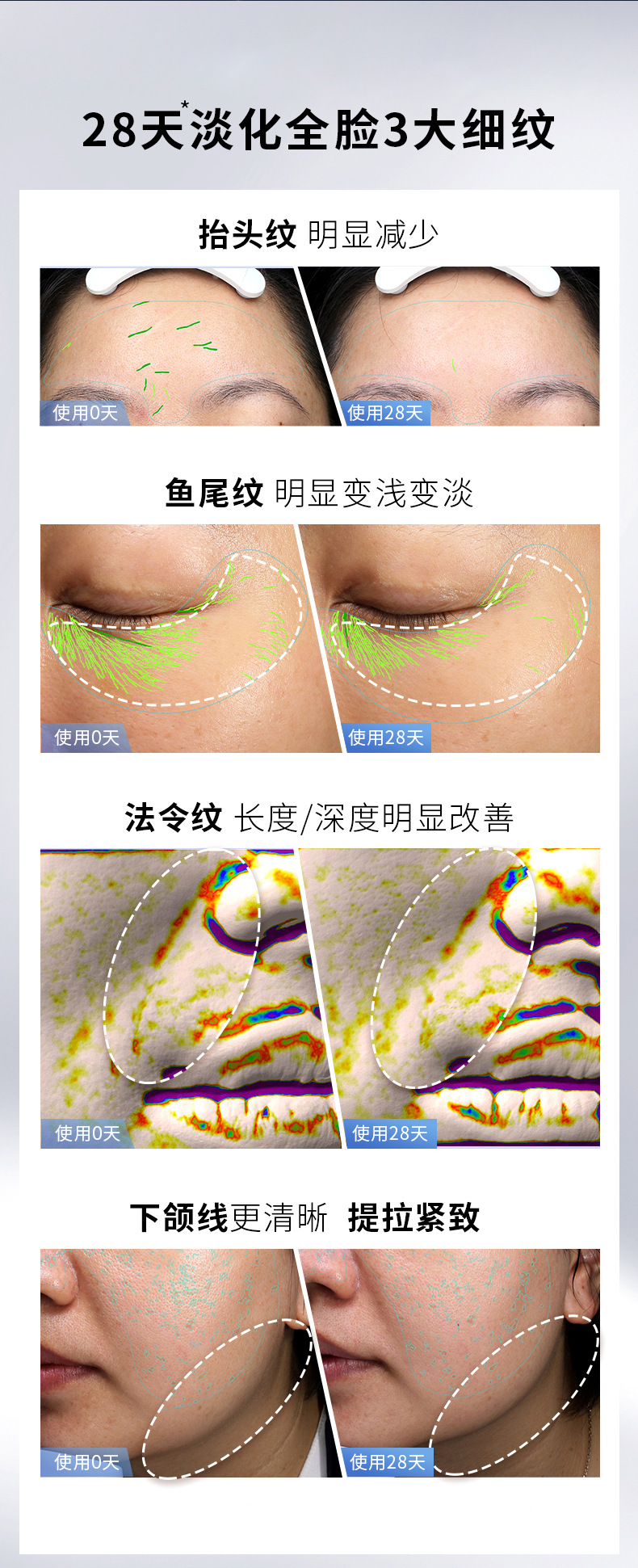 RF新款射频仪脸部提拉紧致红光嫩肤多功能家用美容仪ems跨境批发详情5