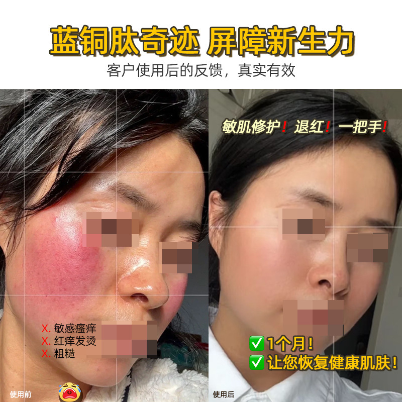 青銅ペプチド修復アイスクリスタル鎮静赤み修復眉ライン保湿修復敏感肌肥厚キューティクルアイスクリスタルクリーム|undefined