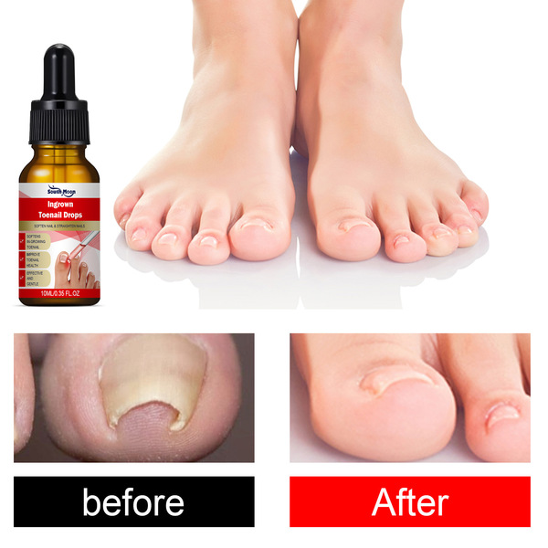 Medical nutritious serum