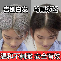 白转黑精华液美容院何首乌营养液滋养头皮修护毛囊防脱育发精华液