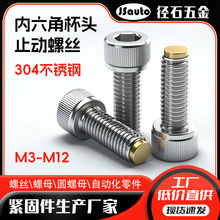 �z���X݆��M�b�����Ǳ��^ֹ���ݽz CBCPS�̶����_�~�^��˨���