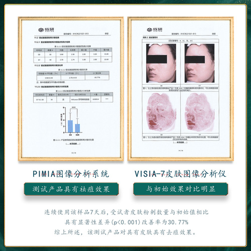 Baizhentang Herbal Extract Acne Cleansing Cream 100g Diminishes Acne Marks Moisturizing Facial Cleanser Manufacturer Wholesale