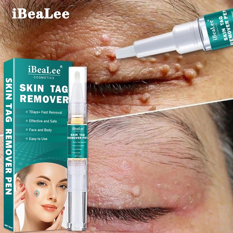 Stift für IBeaLee zum Entfernen flacher, besonders scharfer Warzen, Entfernerflüssigkeit, Creme und Warzenausgleichsflüssigkeit_voghion.com