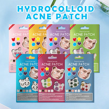 PatchCanvas��ͨˮ�z�w�����N���b�羳acnepatch�rƤ�F؛�S�����l