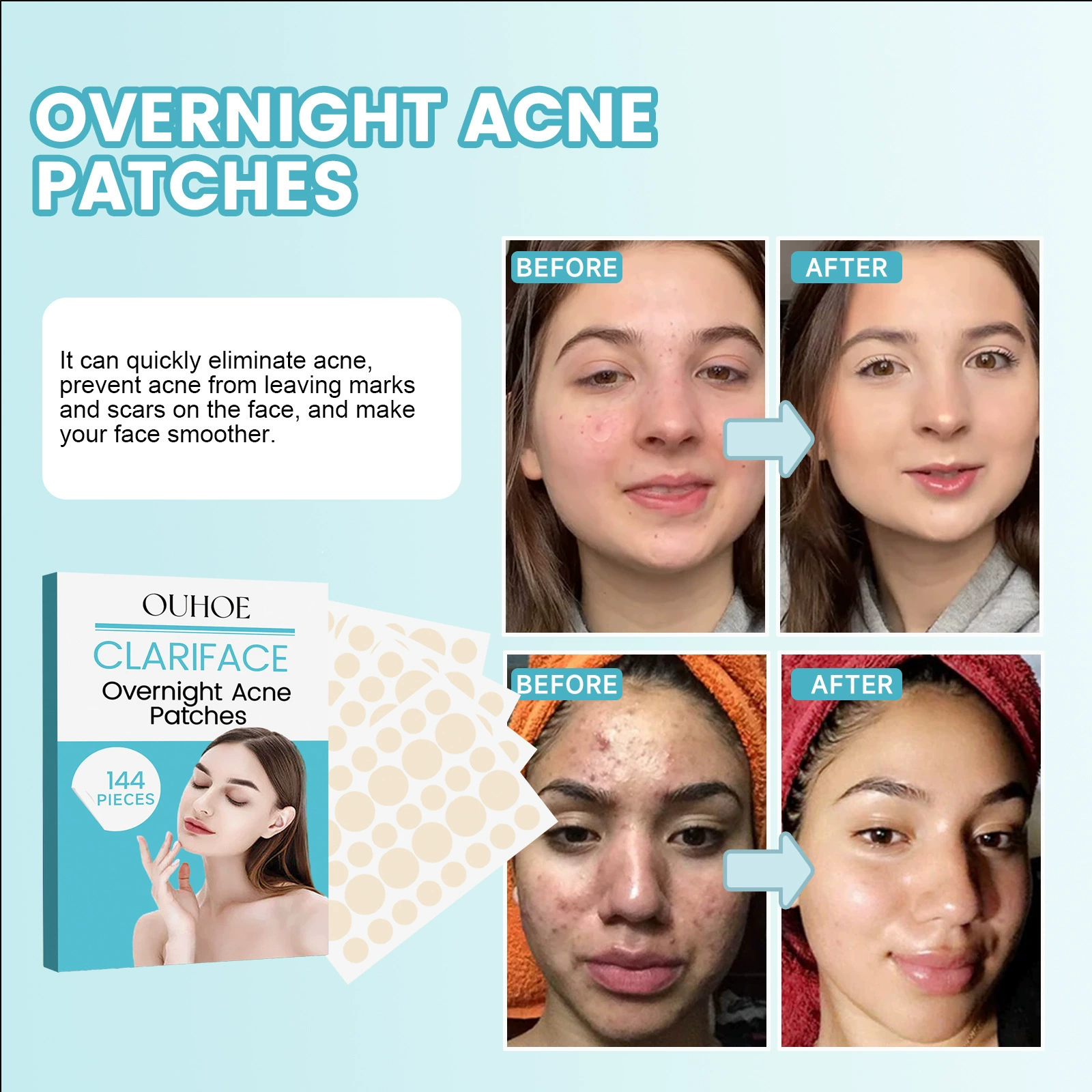 Осветляющая acne-патч OUHOE, дышащий тональный крем для лица от черных пятен, скрывает акне