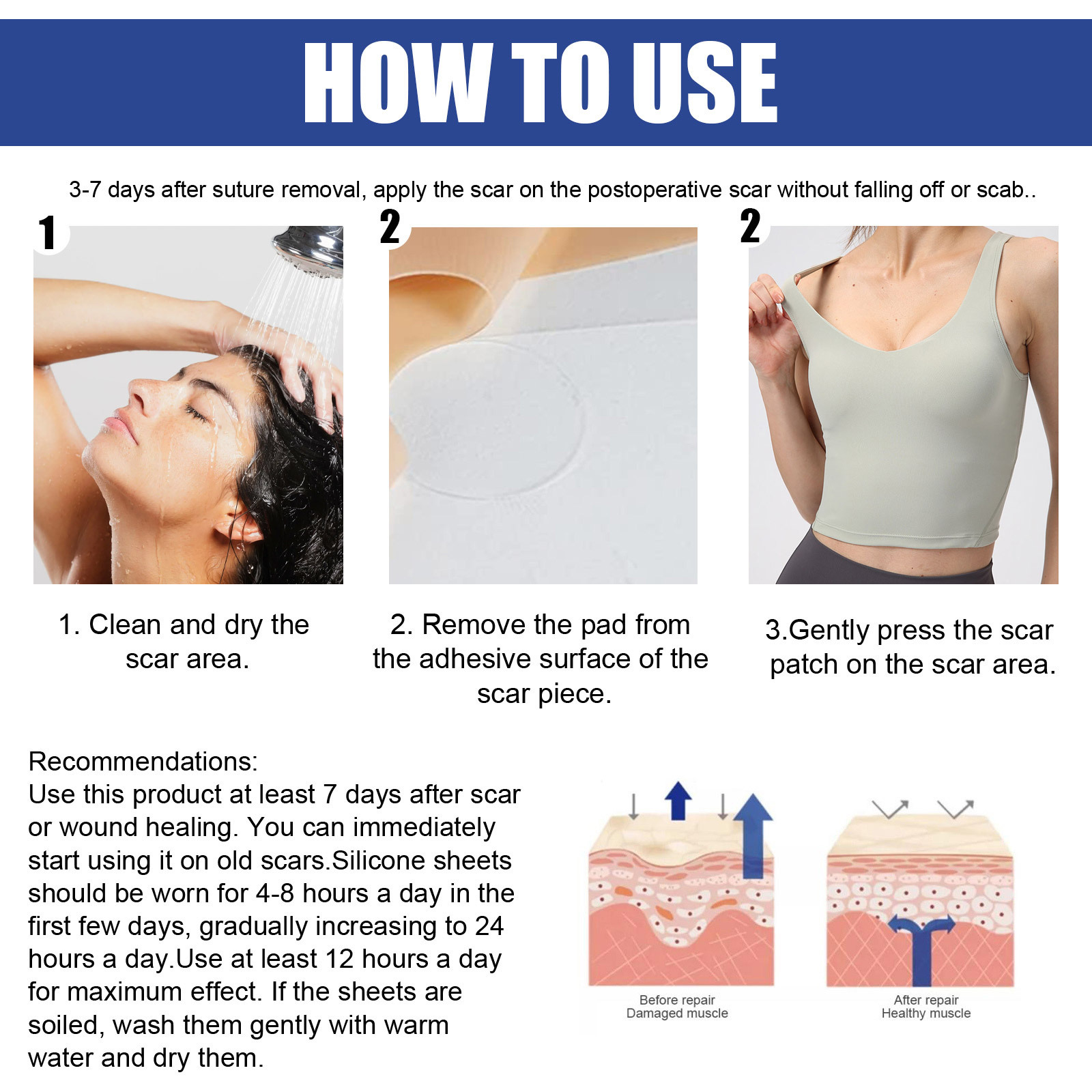 EELHOE Patch per cicatrici al seno Ripara le cicatrici della pelle, è comodo, leggero e leviga le cicatrici chirurgiche al seno, (confezione da 2)_voghion.com