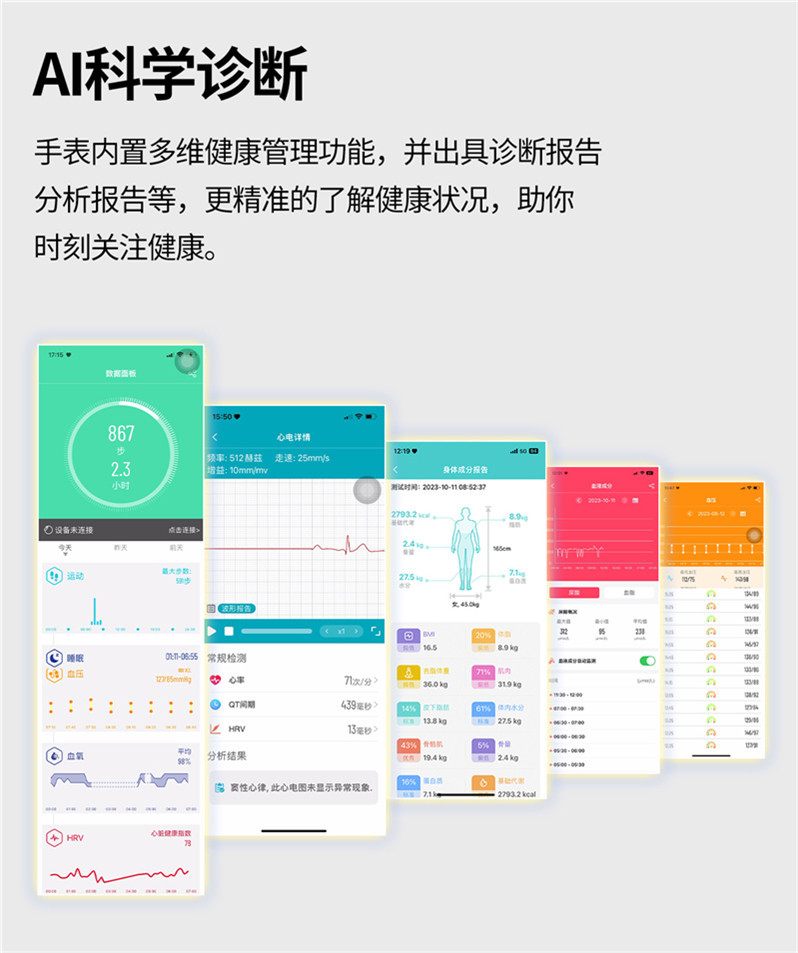 The new cross-border ET580 smartwatch features Bluetooth calls, ECG, electrocardiogram, and does not measure blood sugar, uric acid, blood lipid, body temperature, or exercise undefined