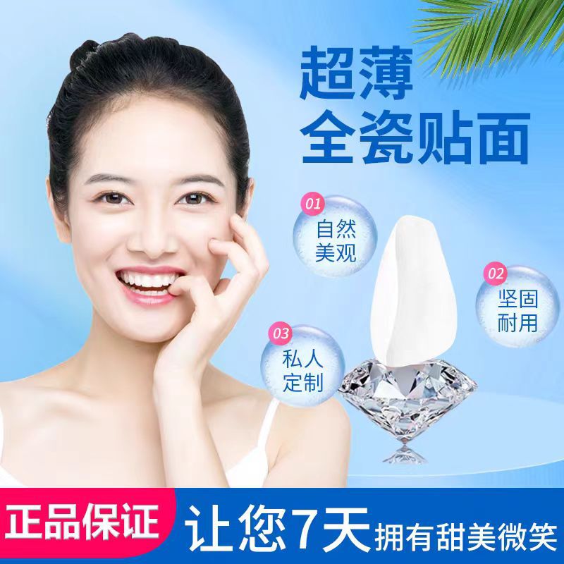 全瓷贴面义获嘉蓝瓷美白遮色正品德国美国原材料工厂直供美牙贴片