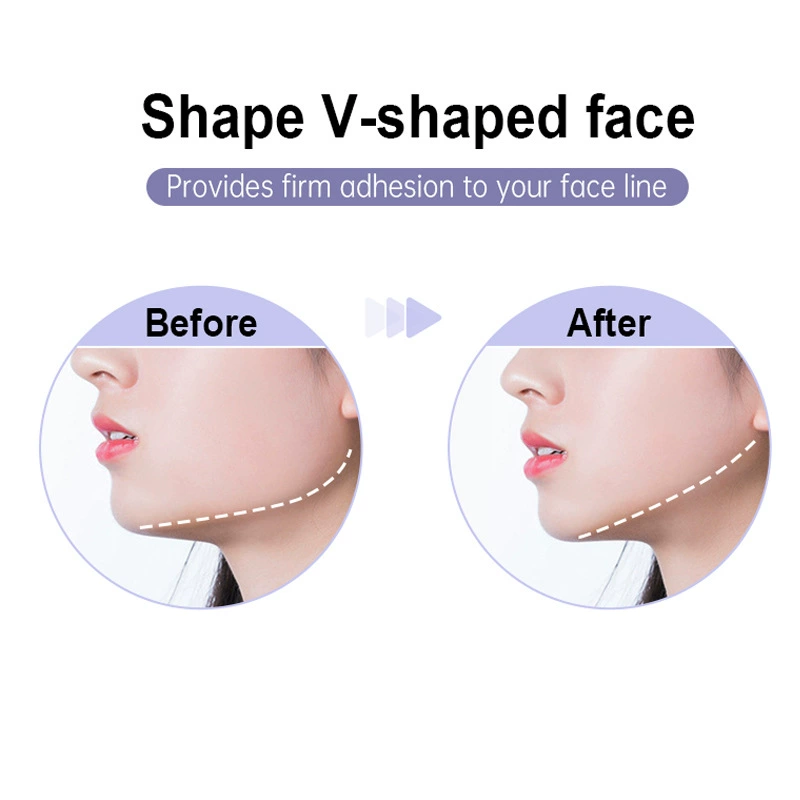 Gel, pulls up ears stickers for face, anti-wrinkle