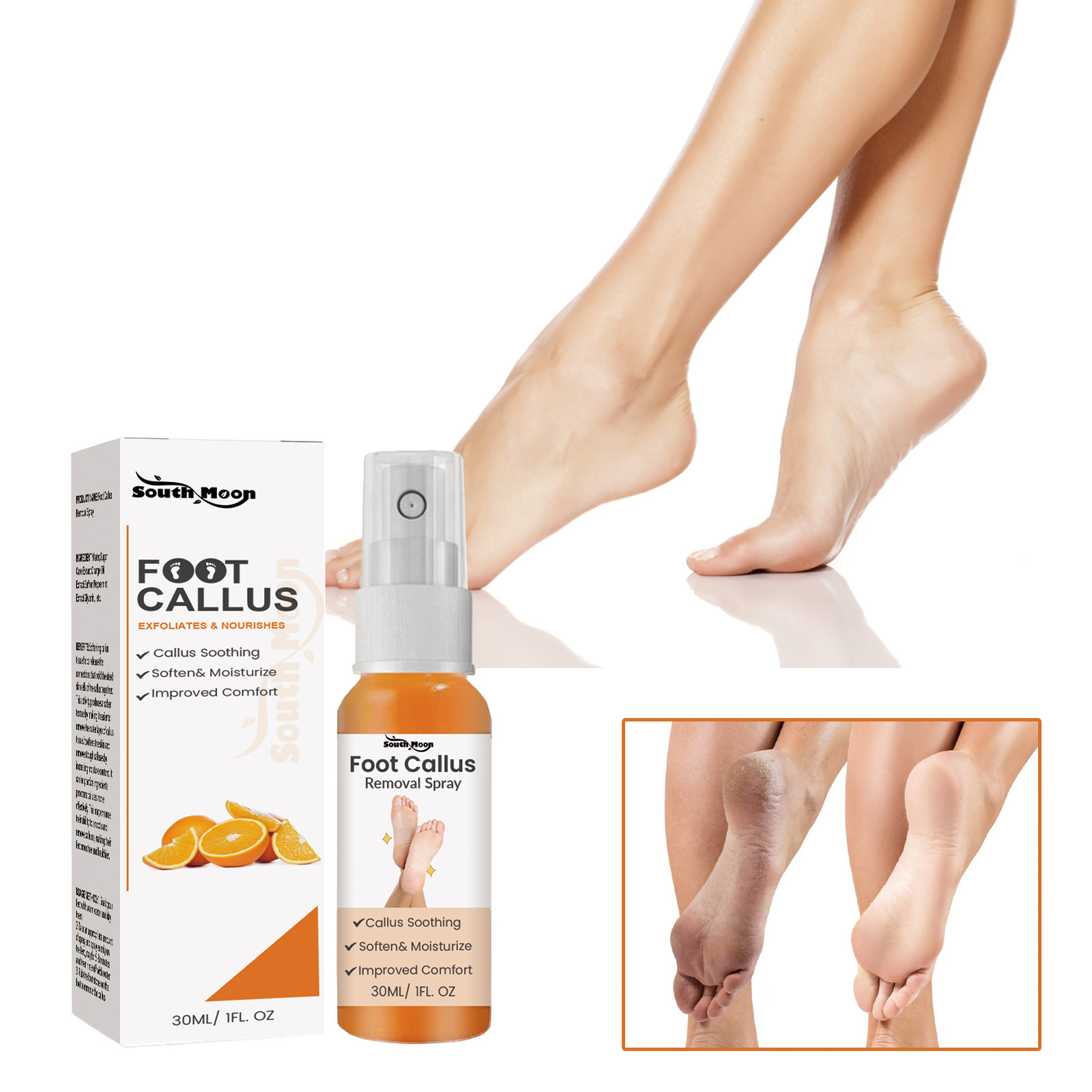 South Moon Foot Exfoliating Spray - Dead Skin Cracking Moisturizing Hydrating Cleansing Repairing Rough Callus Removal