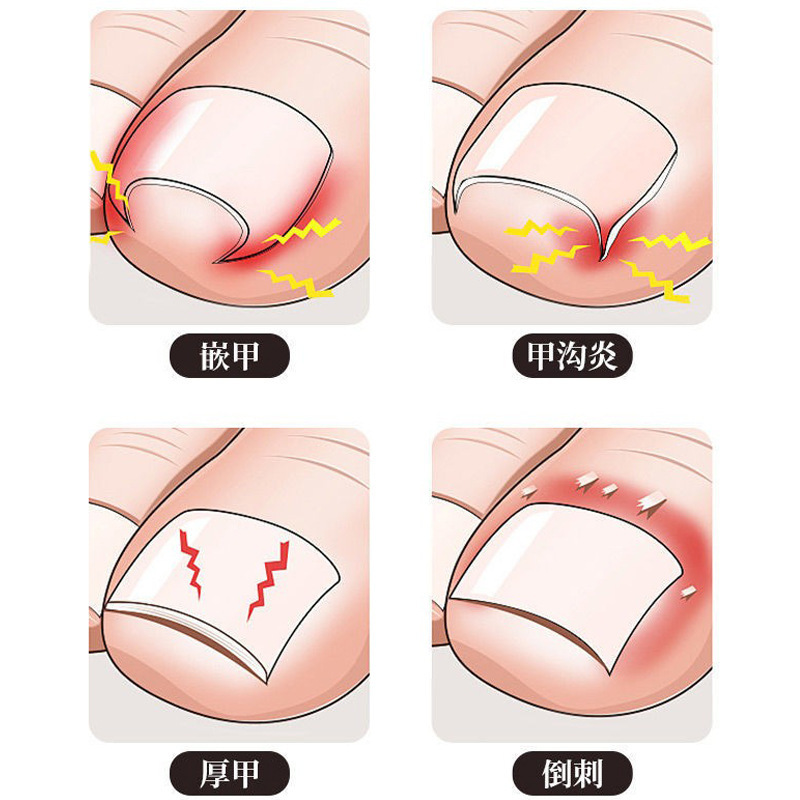 Factory direct sales eagle beak nail clipper, large nail clipper set for toenail and ingrown nail care, for nail groove inflammation.