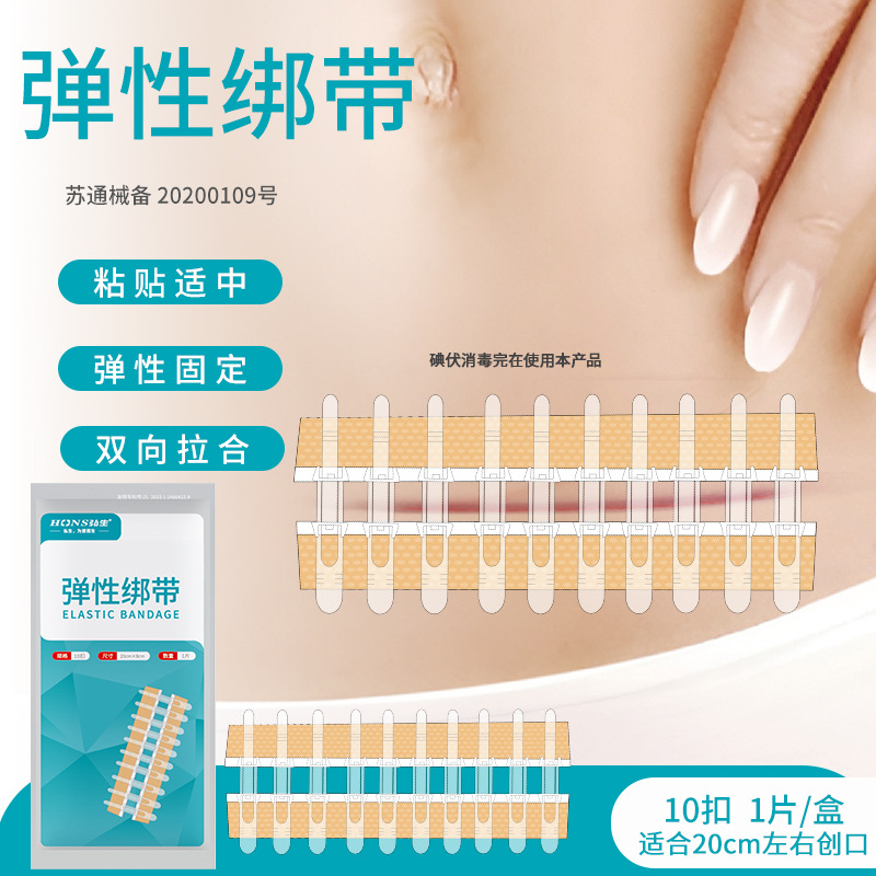 ホンシェン張力緩和器、縫合不要創傷閉鎖器、不織布ジッパー式創傷パッチ、皮膚張力緩和吻合器