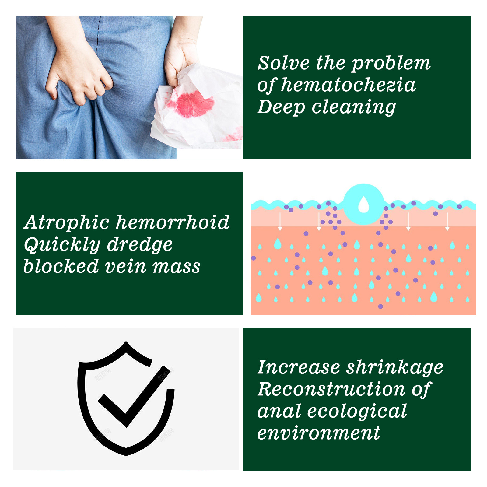 South Moon hemoroīdu noņemšanas kotlešu tūpļa komforta kopšanas ziede, mazina niezi, pietūkumu un sāpes_voghion.com