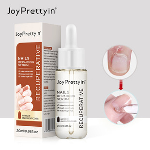 Joyprettyin Cross-Border Hand and Foot Nail Repair Solution Nourishing Anti-Hangnail Polish Soft Nail Care Finger Edge Oil