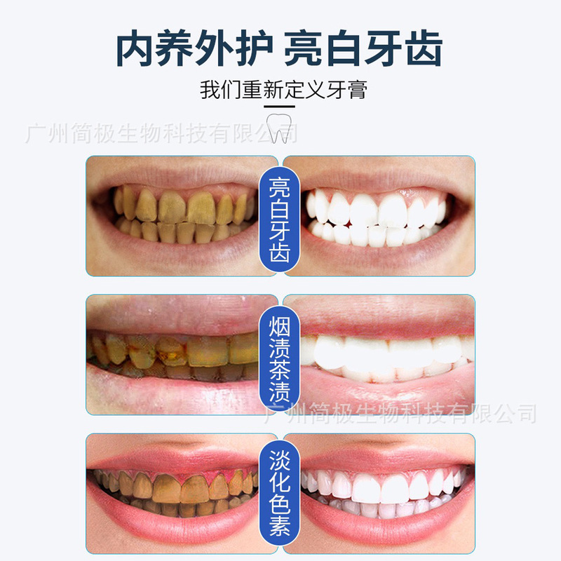 南京同仁堂熊は歯磨き粉を防ぎ、歯茎を保護します。|undefined