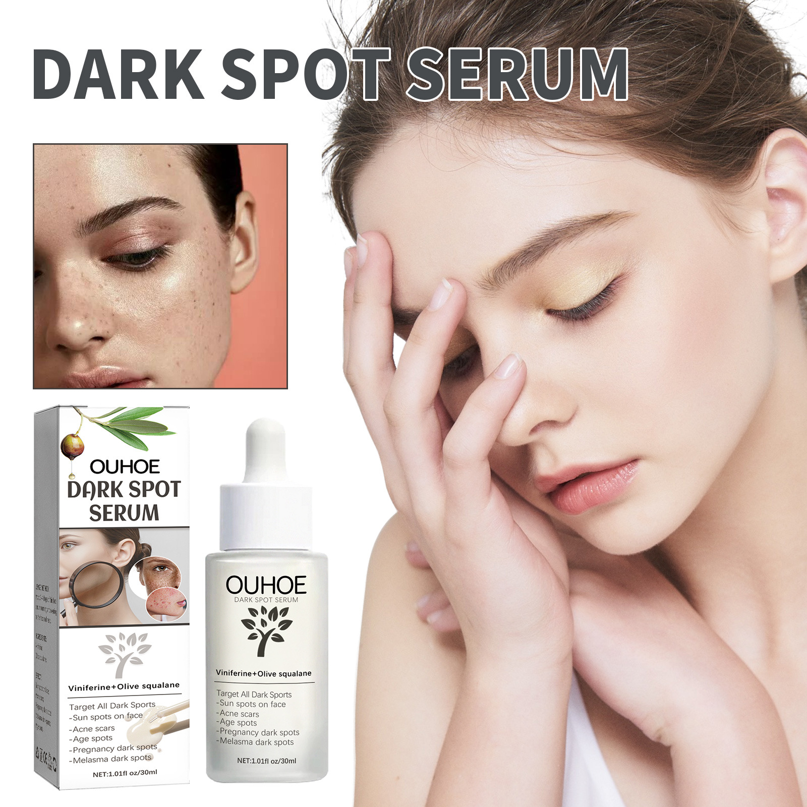 OUHOE Dark Spot&Acne för att bleka fläckar, återfukta huden, reparera aknemärken, mörka och ljusa upp ansiktets essens_voghion.com
