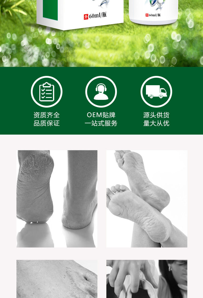 Yunnan Herbal Foot Itch Relief Spray 60ml External Foot Care Liquid specifications