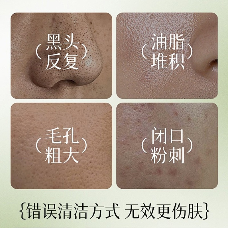 Filipinas LVFEI máscara de control de aceite para absorber los puntos negros, máscara facial para absorber los puntos negros, máscara para eliminar los puntos negros, máscara facial para eliminar los puntos negros