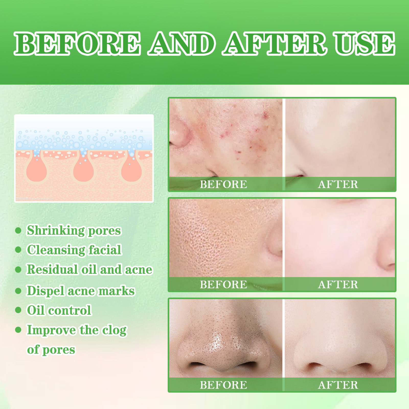 EELHOE Tampone detergente all'acido salicilico per punti neri e rimozione, controllo dell'olio a bocca chiusa, idratante, pulizia delicata,_voghion.com