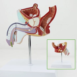 Male internal reproductive pathology model lesions reproductive anatomy model male urinary system disease model male