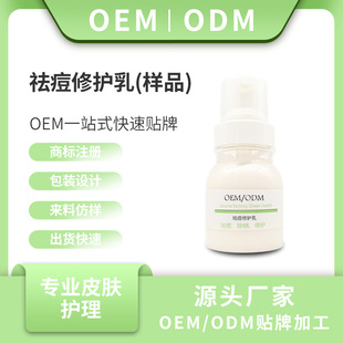 (Lotion Oen/Odm) Acne