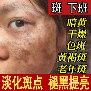 美白淡斑