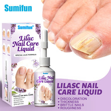 sumifun�羳��óϺƤ�����ָ�׻���Һ�ֲ�ָ�ױ�ɫ���� K60051