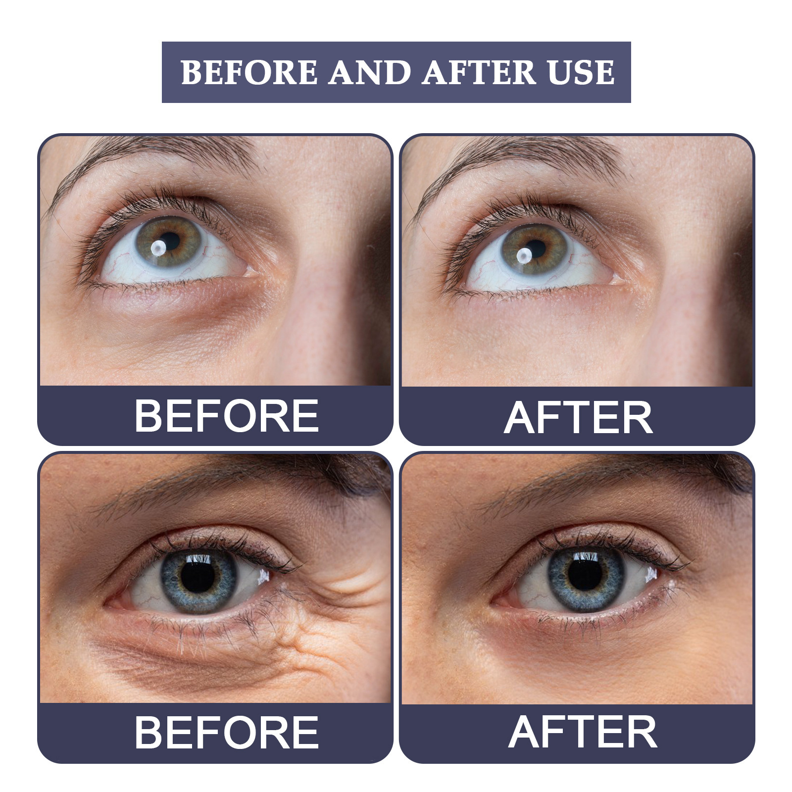 Krema proti gubam Jaysuing za posvetlitev drobnih gubic v kotičkih črnih kolobarjev pod očmi in učvrstitev podočnjakov_voghion.com