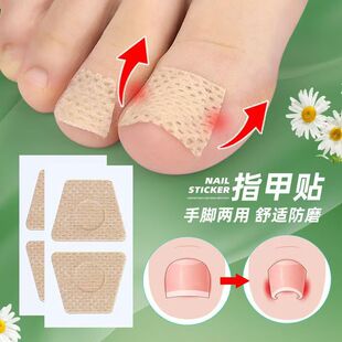 Nail care patch inlaid nail groove into the meat long toe pad protective patch soft nail onychomycosis orthopedic patch