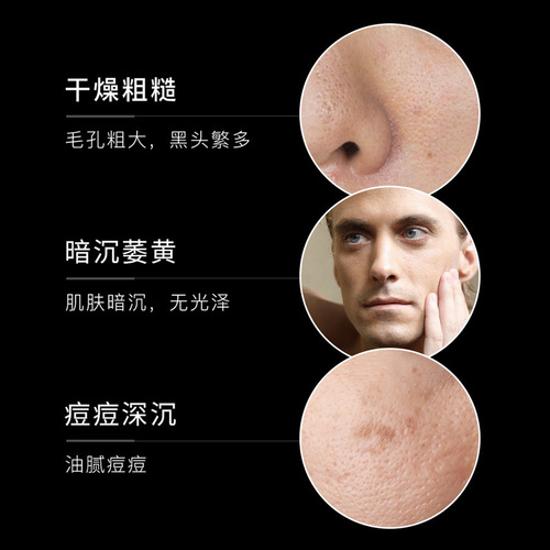 Fanzhen Men's Facial Cleanser Hydrating Skin Care Product Set Moisturizing Toner Cream Cleanser Su Yan Cream Wholesale