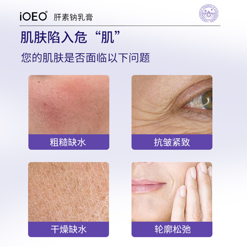 iOEO ヘパリンナトリウムクリーム抗しわ引き締め乾燥ピーリング小じわを軽減高保湿アイクリーム卸売|undefined