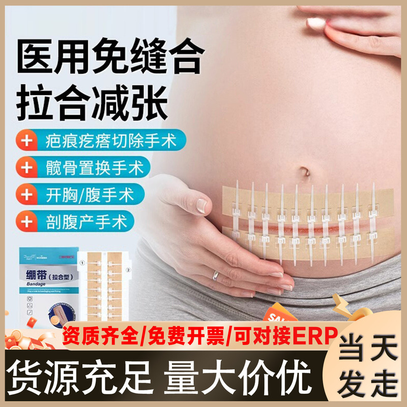 ハイシーハイノ医療用緊張緩和器10バックル弾性包帯、縫合不要の帝王切開皮膚創傷閉鎖テープ|undefined