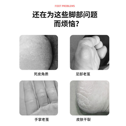 Foot scrubber to remove dead skin, foot grinder, heel callus file, foot scraper, foot scraper, pedicure planing tool set