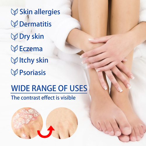 South Moon Skin Itching Lotion