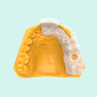 专业级3D打印高精度快速固化成型手术导板光敏树脂-阿里巴巴