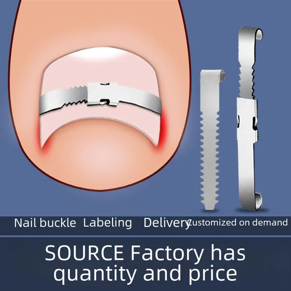 Nail button nail nail pricking lala patch toenails into the meat long pricking flesh correction nail correction appliance inflammation