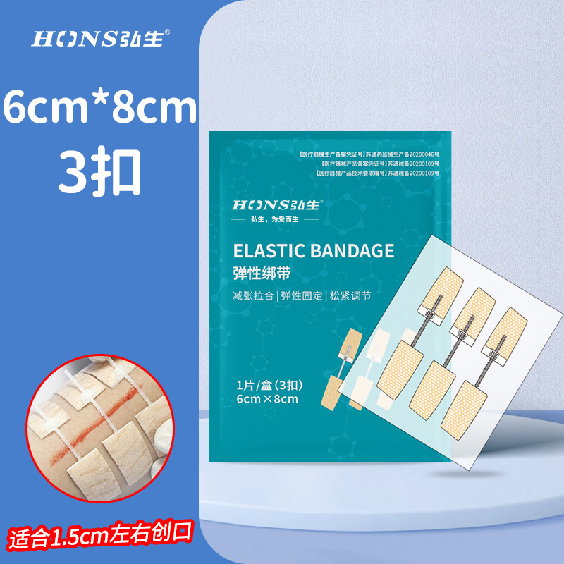 ホンシェン張力緩和器、縫合不要創傷閉鎖器、不織布ジッパー式創傷パッチ、皮膚張力緩和吻合器