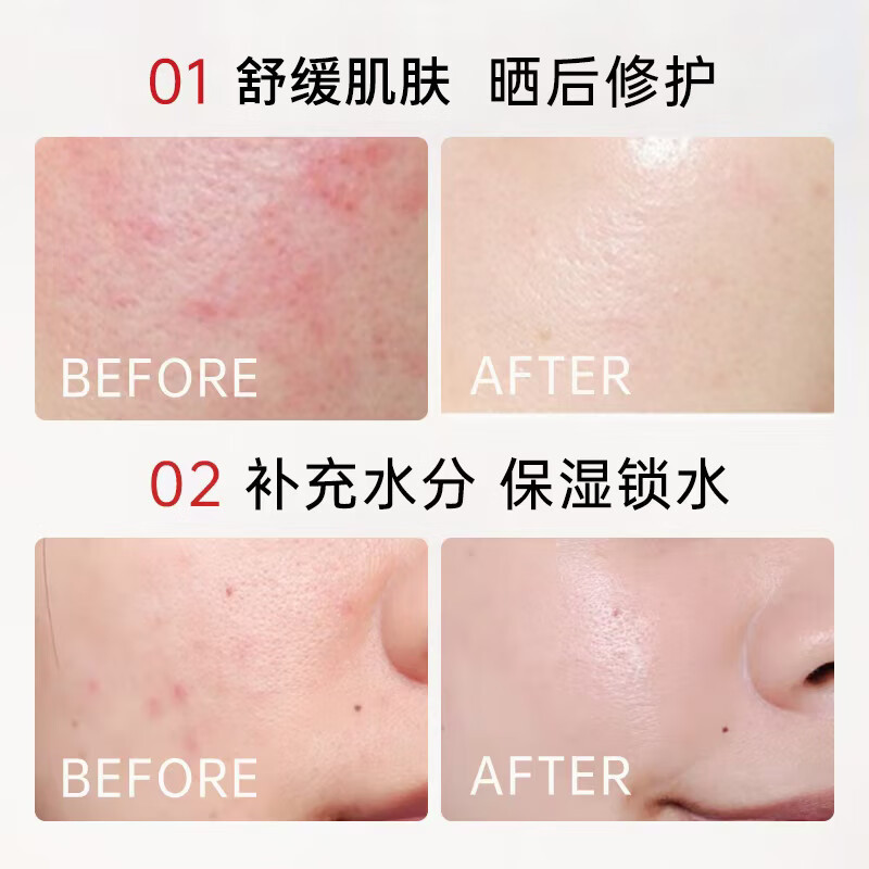 HJZZ保湿舒缓修肤面霜补水保湿修护肌肤屏障改善干燥泛红起皮退红|undefined