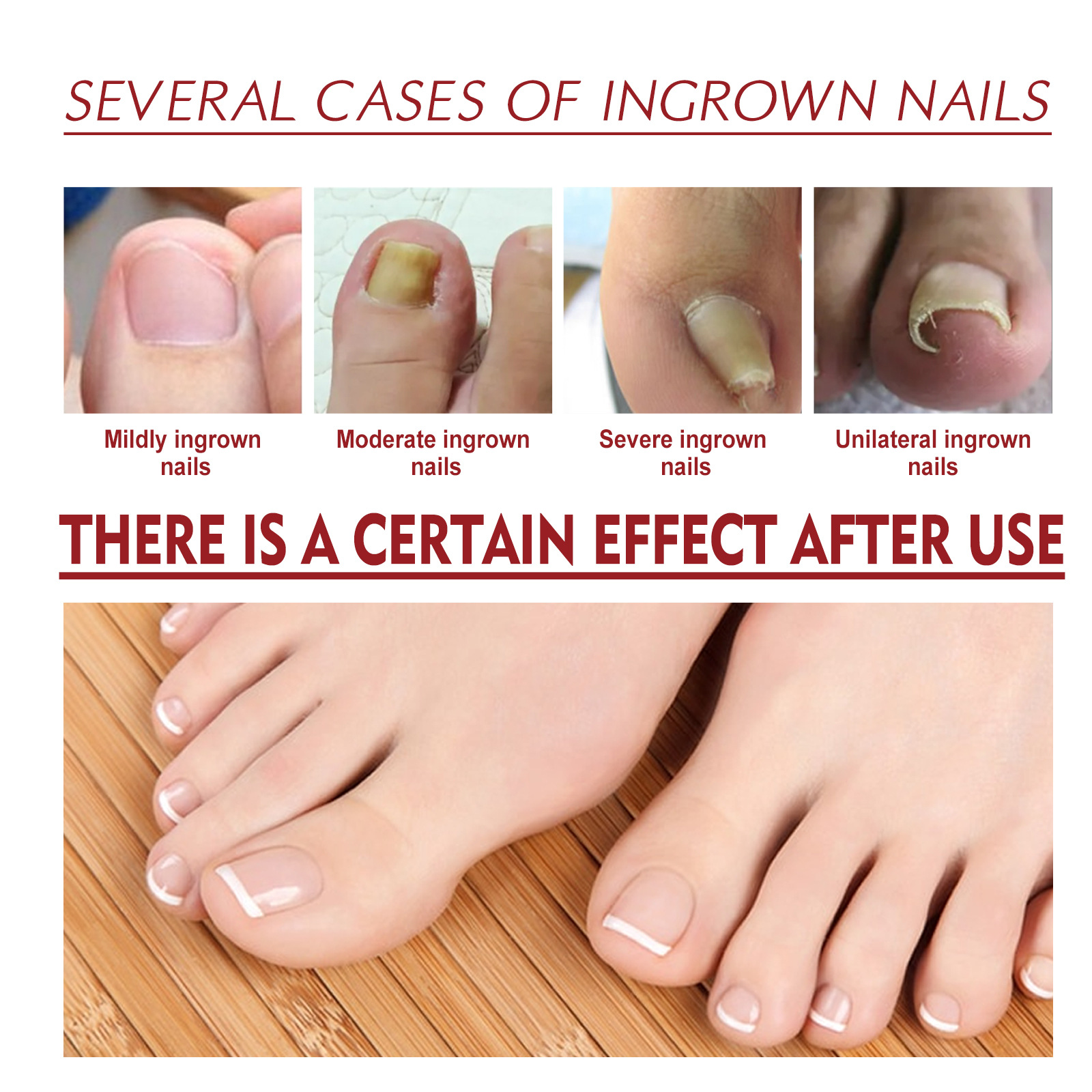 Jaysuing Anti-Inflammatory Relief Oil Image 6