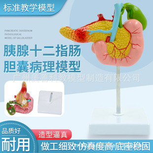 仿真病变胰腺十二指肠胆囊病理模型消化系统肝脏胰脾肠道标本教学-阿里巴巴