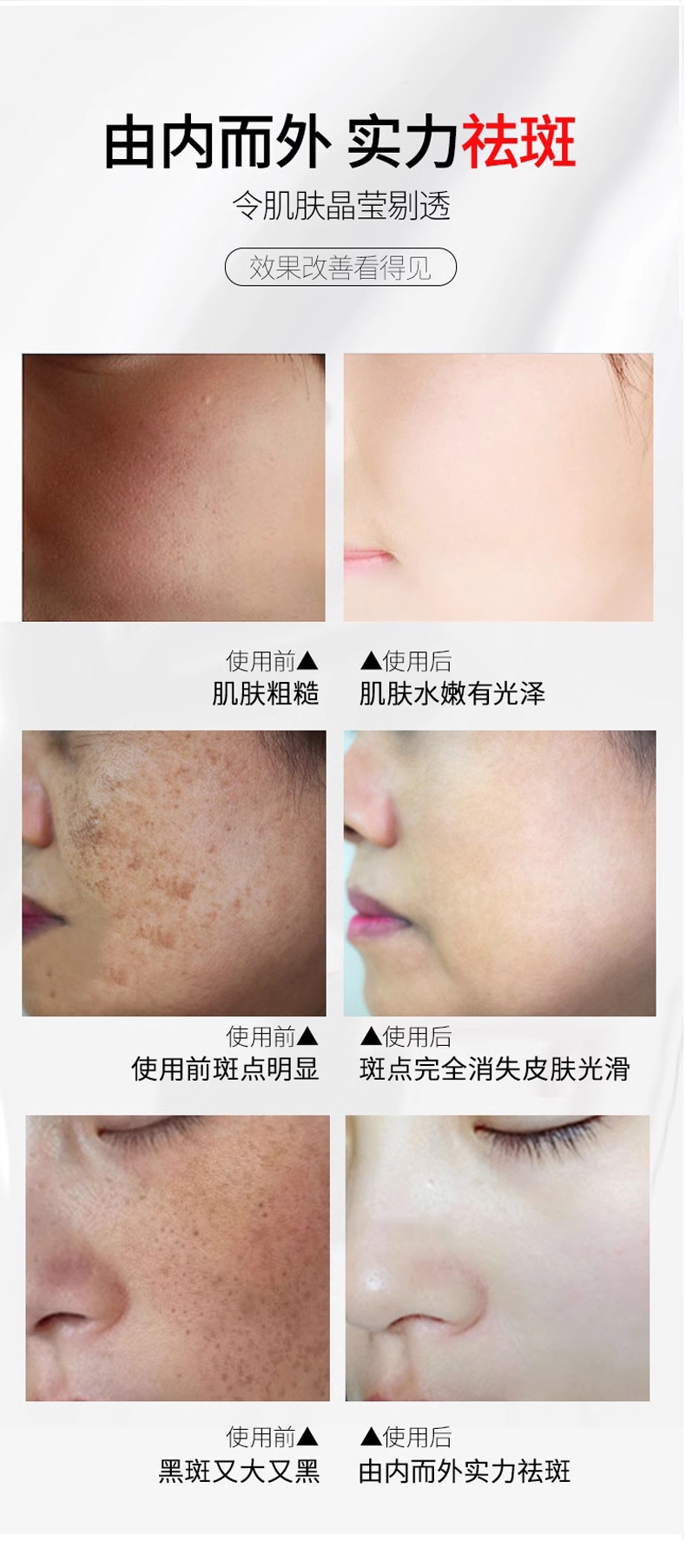 花姬賞美白淡斑精華液,提亮肌膚暗沈煙酰胺保濕細致祛斑次拋原液 花姬賞美白祛斑精華液_08.jpg